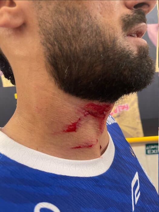 تصویر خبر: اعتراض باشگاه استقلال به رفتار غیرورزشی مدافع پرسپولیس در شهرآورد
